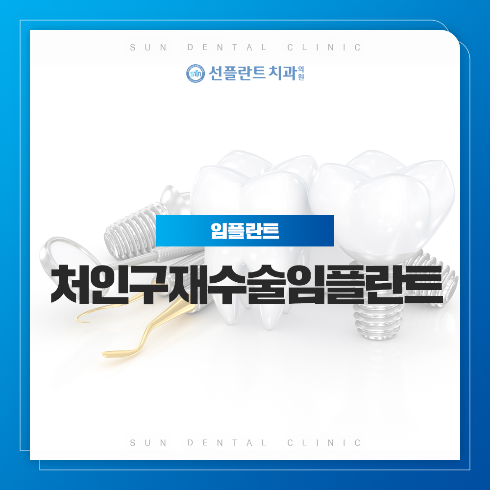 용인선플란트치과-처인구재수술임플란트-임플란트썸네일