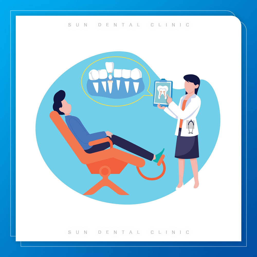 용인선플란트-처인구수면치과-임플란트를 설명하고 있는 일러스트