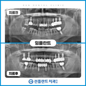 처인구수면치과