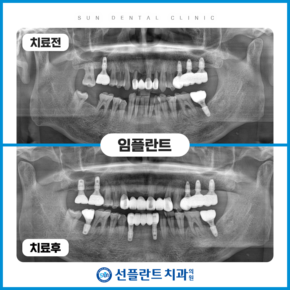 처인구수면치과