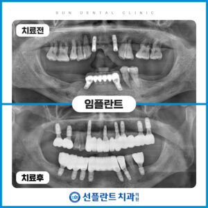 증례블홈_타이틀