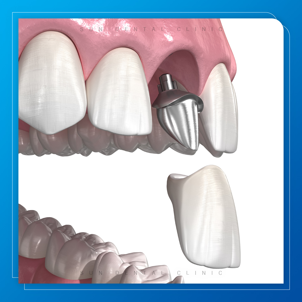 김량장동수면치과