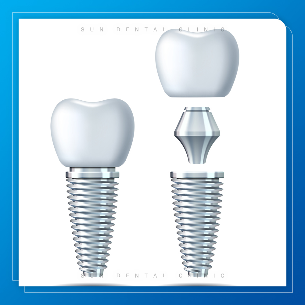 김량장동수면치과