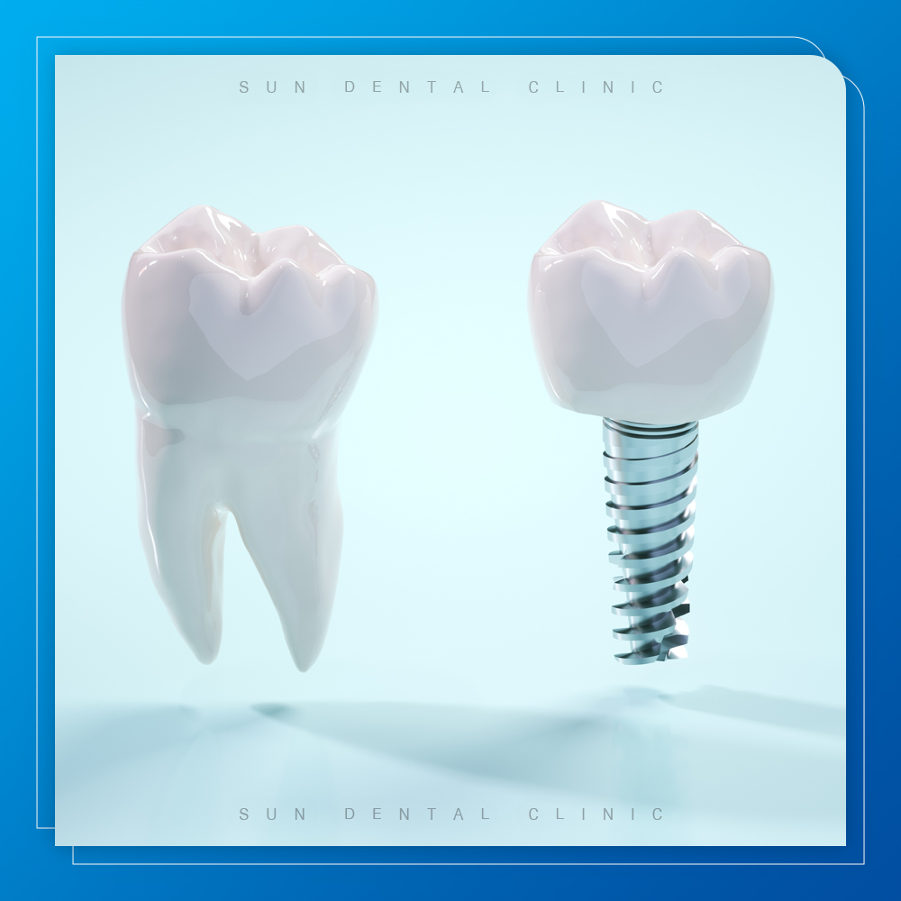 김량장동수면치과