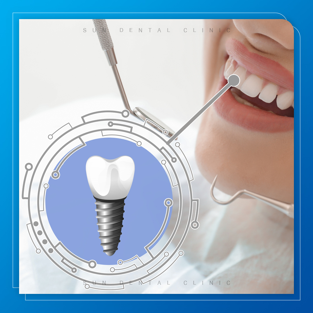 처인구수면치과