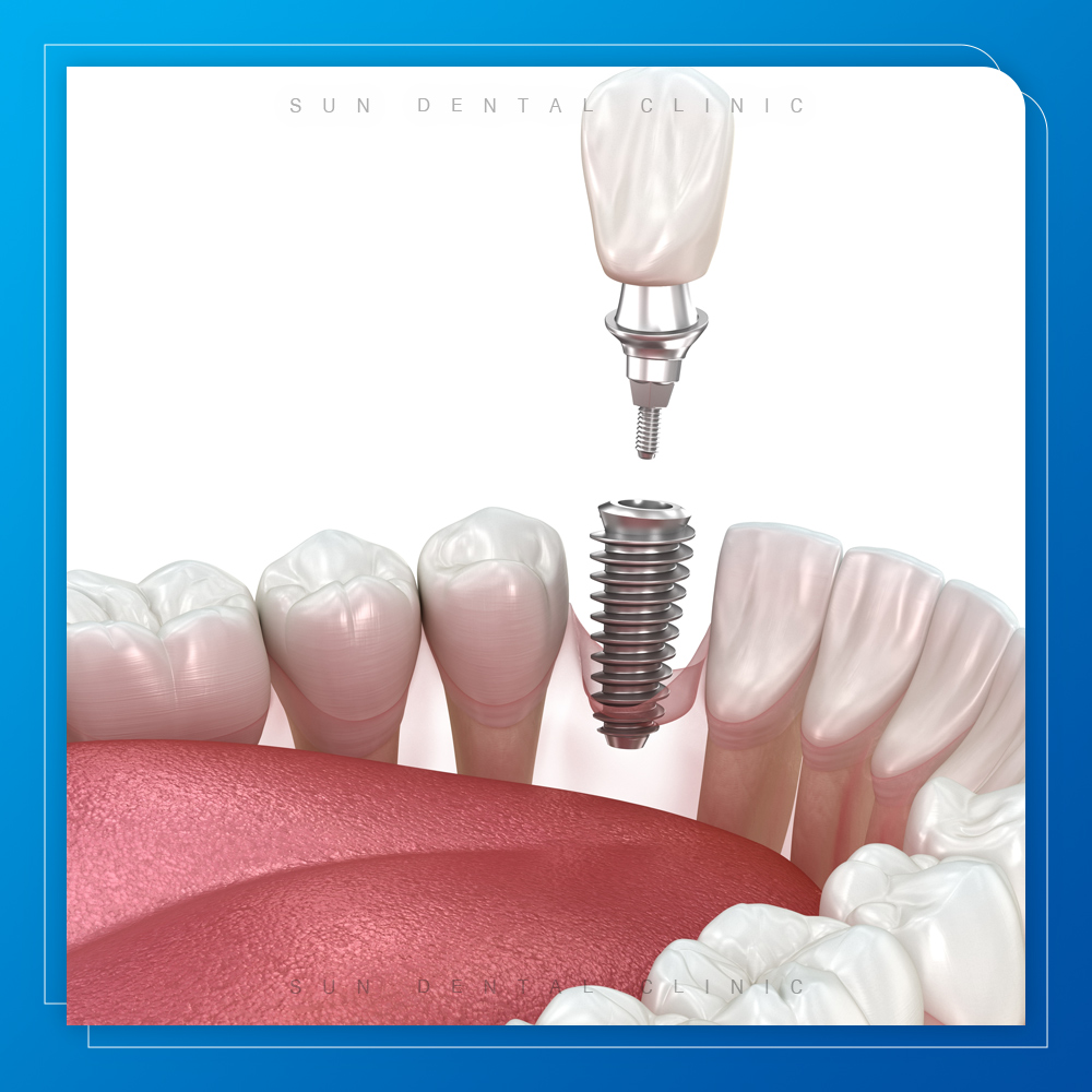 처인구수면치과