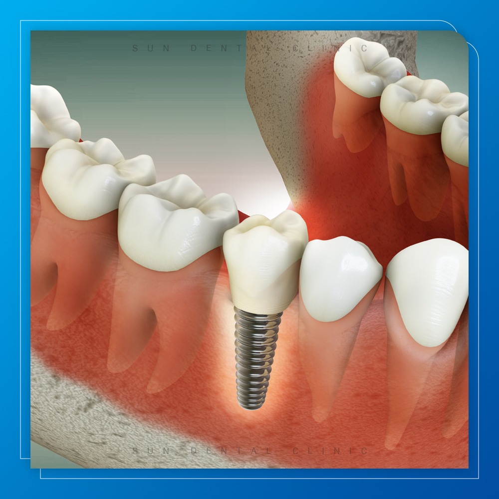 처인구수면치과