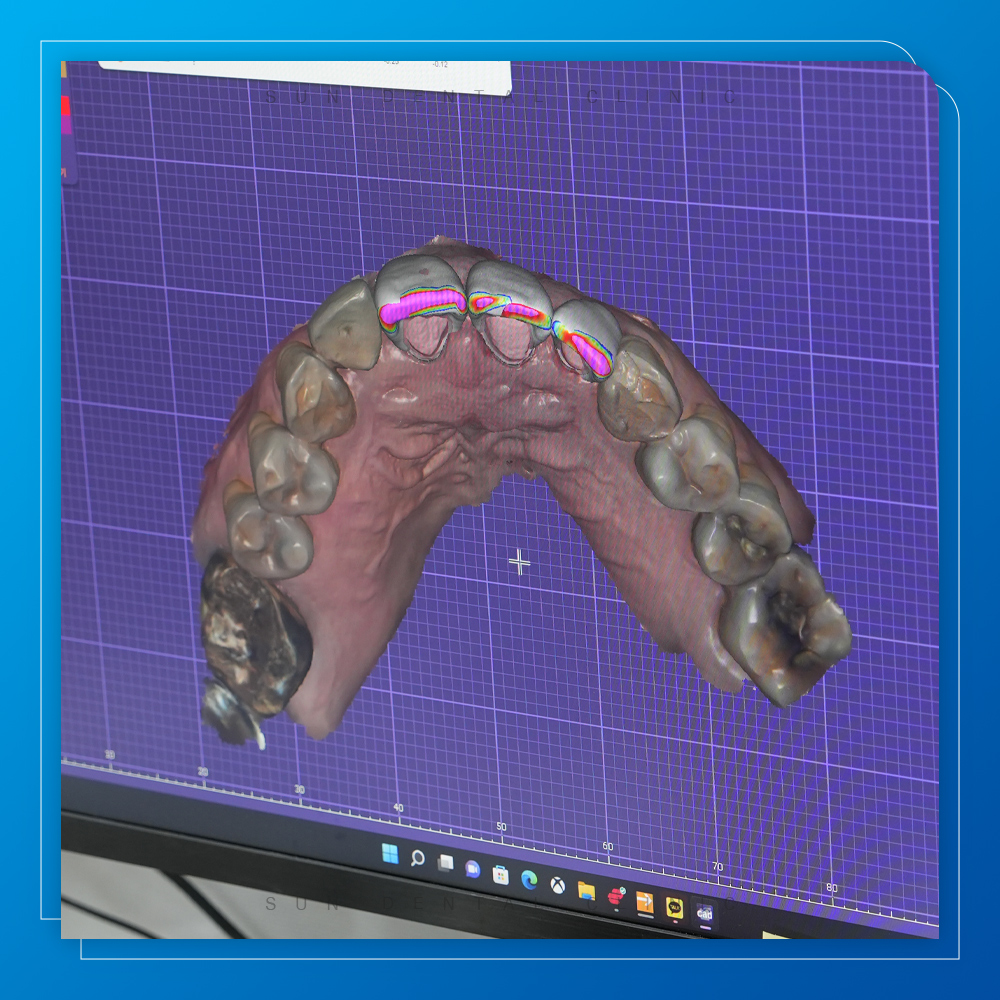 처인구수면치과
