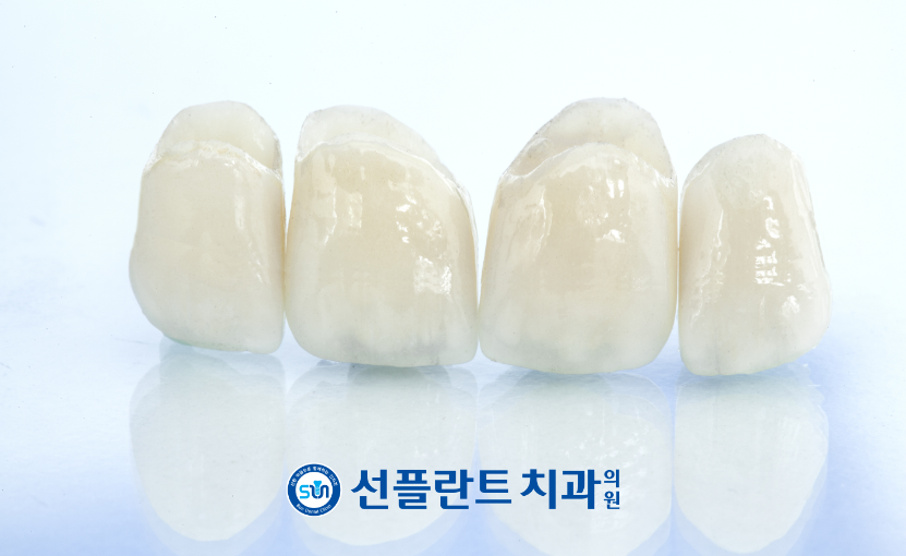 용인선플란트치과