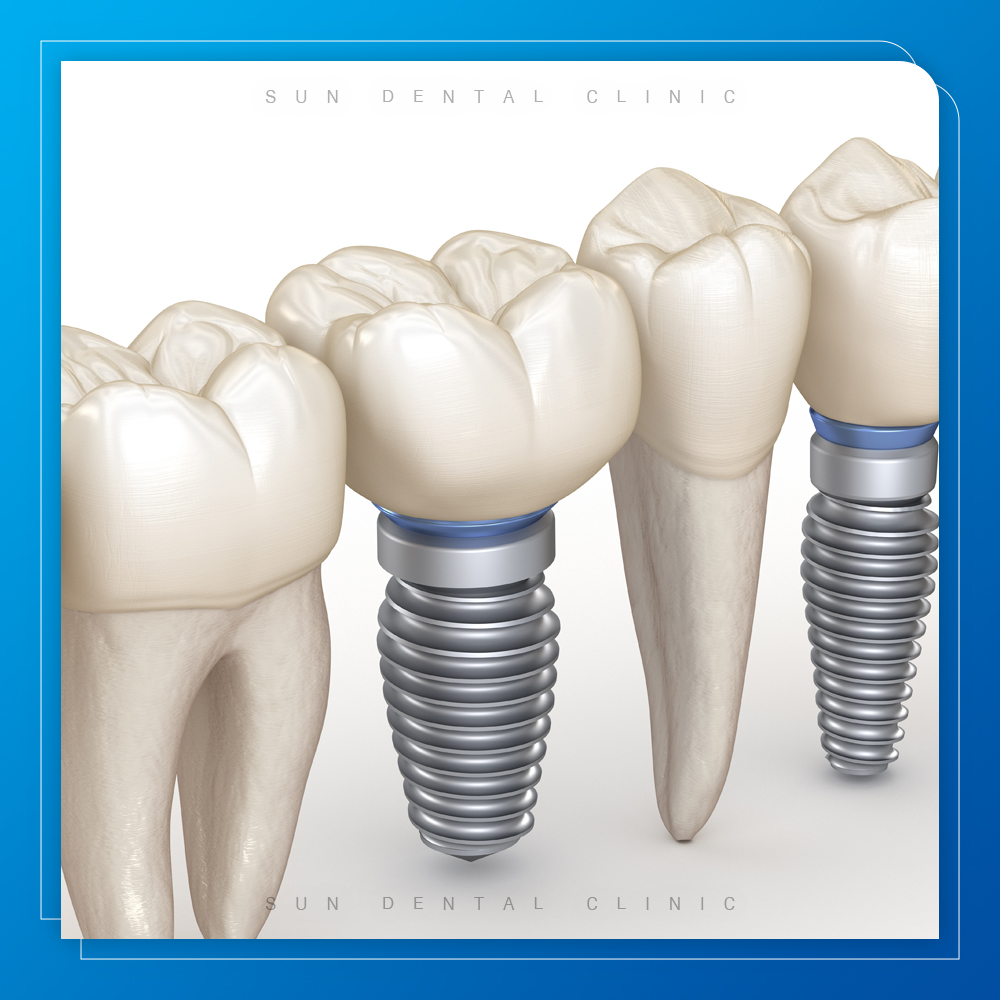 처인구수면치과