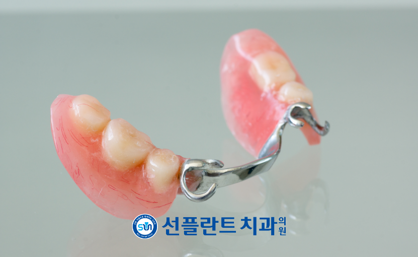 처인구임플란트