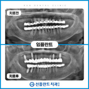 0527증례