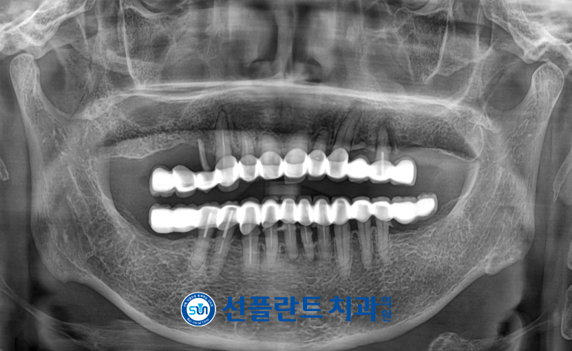 처인구일요일치과
