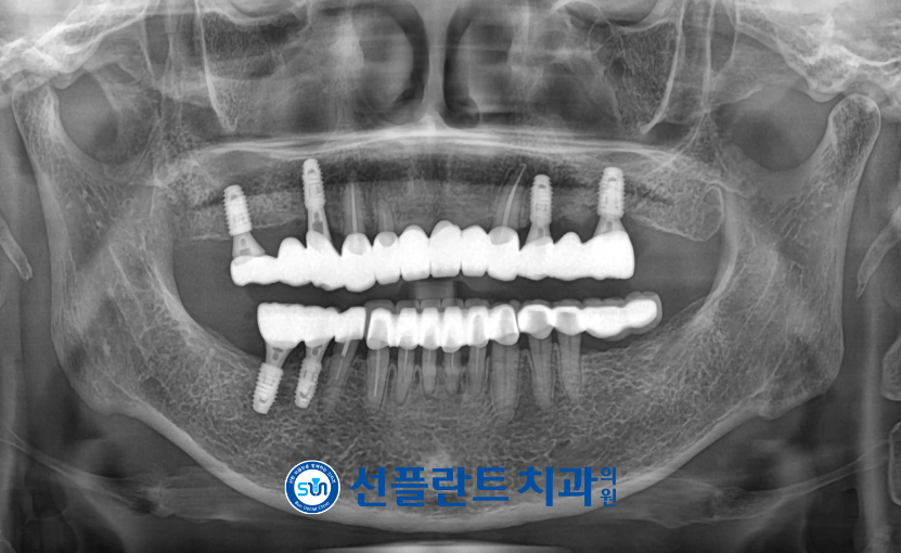 처인구일요일치과