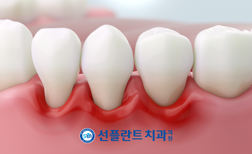 처인구일요일치과