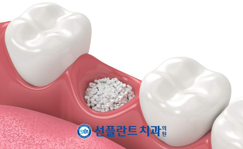 처인구일요일치과