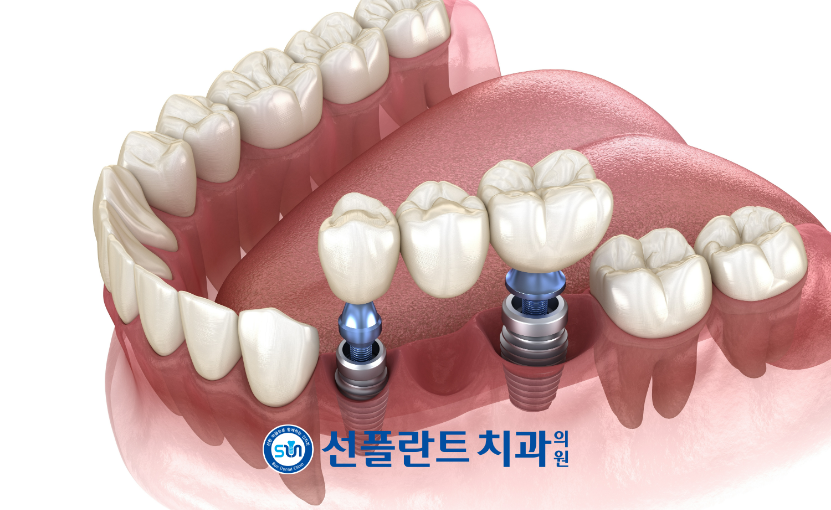 처인구일요일치과