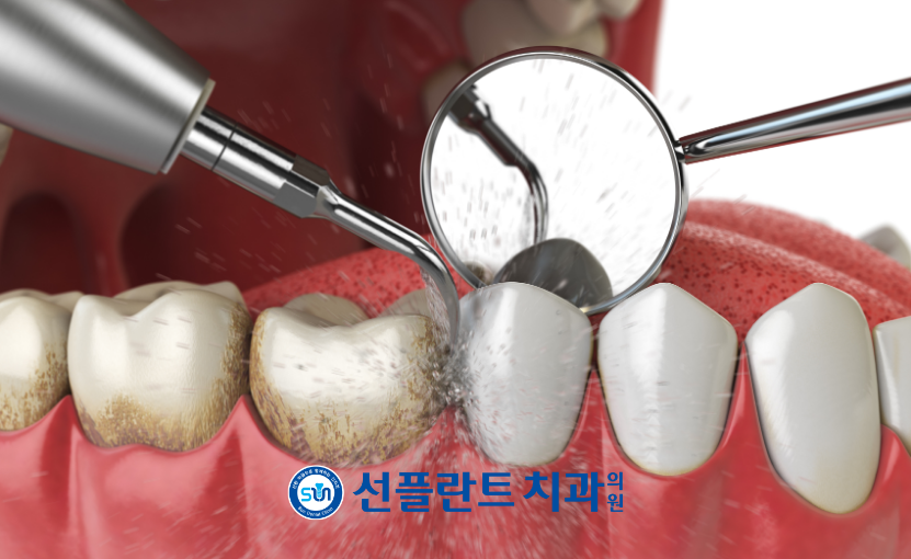 처인구일요일치과
