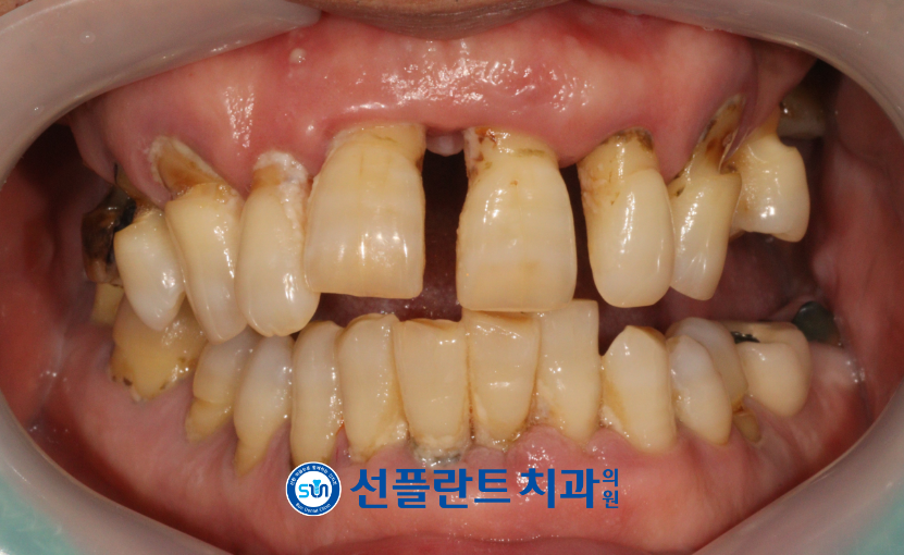 처인구수면치과
