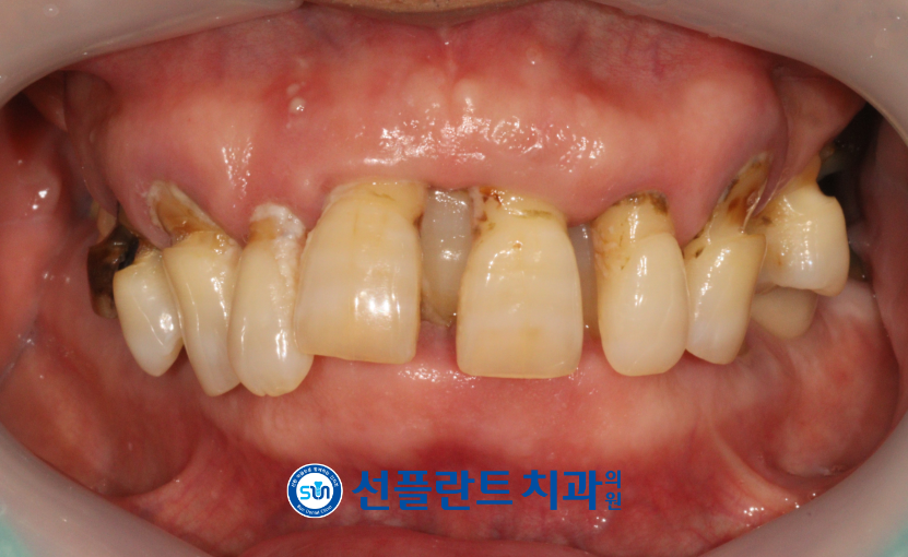 처인구수면치과