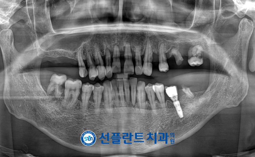 처인구수면치과