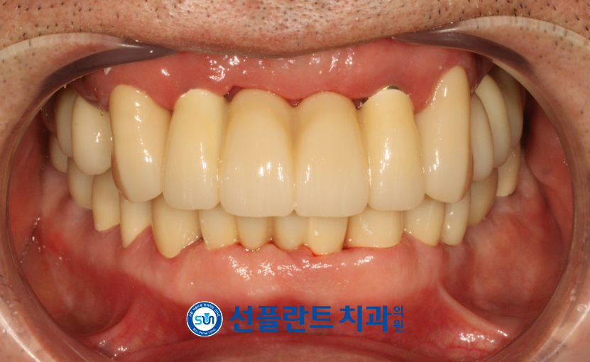 처인구수면치과