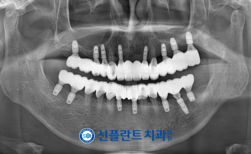 처인구수면치과