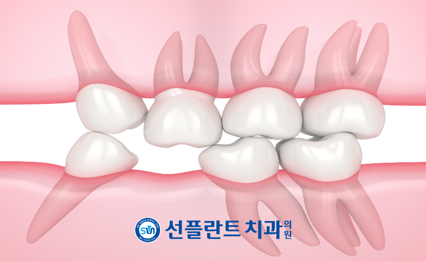 처인구수면치과