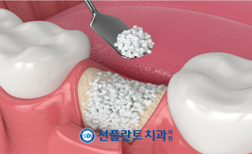 처인구수면치과