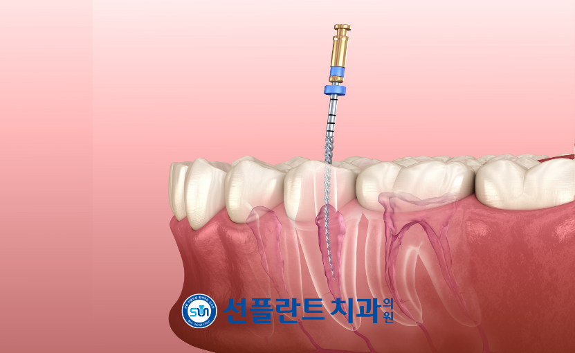 처인구수면치과