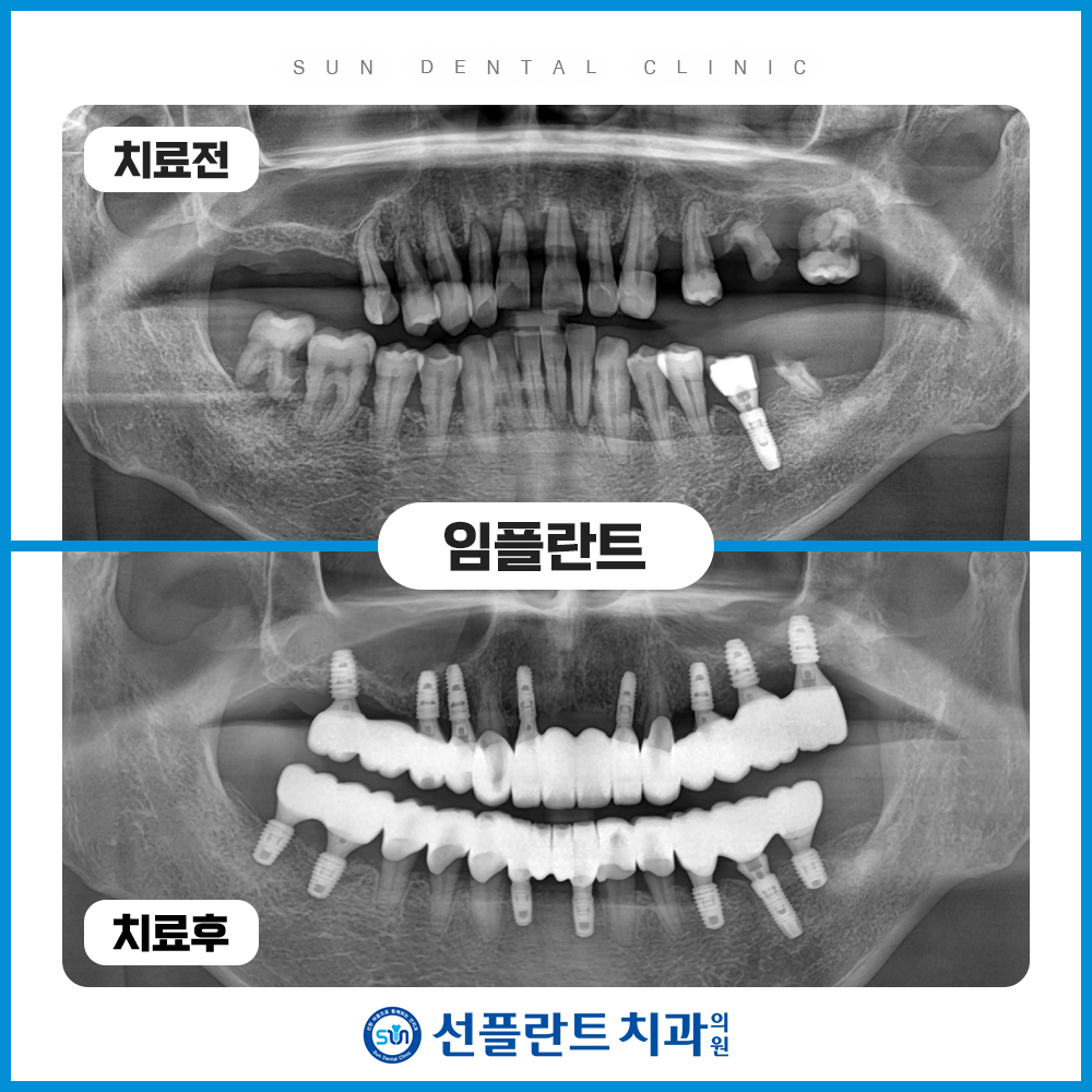 처인구수면치과